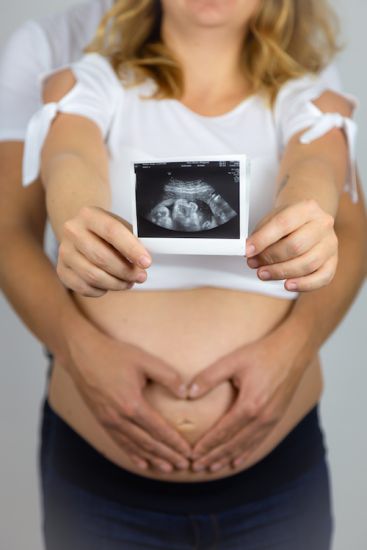 Brustbild eines Paars, dass eine Ultraschallaufnahmen ihres Kindes in die Kamera hält